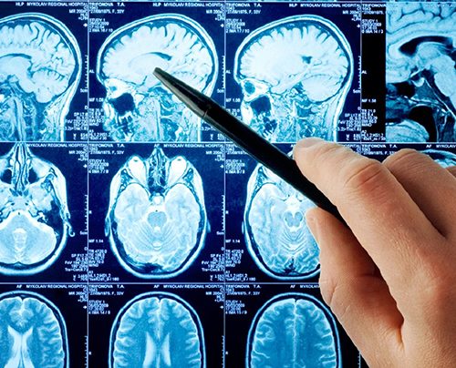 Neurología