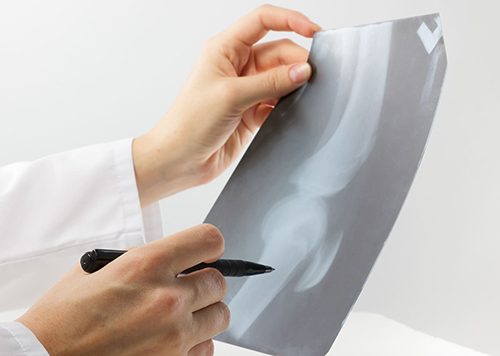 Traumatología