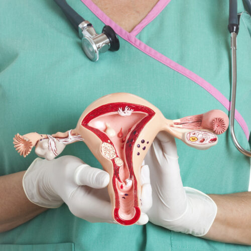 Lesiones de cuello uterino: diagnóstico y tratamiento