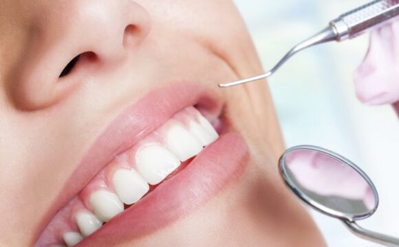 Profiláxis Dental