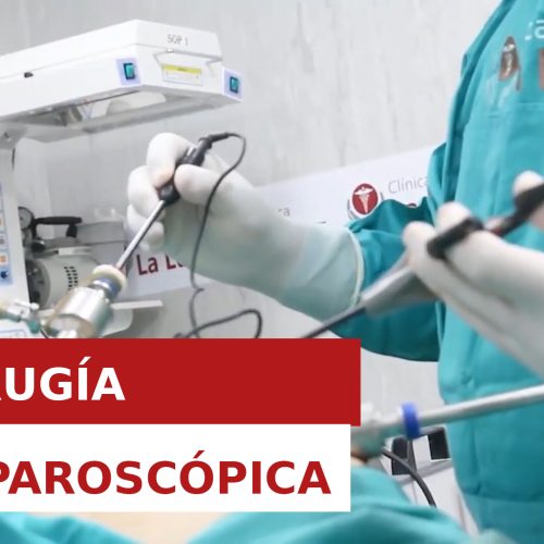 CIRUGÍA LAPAROSCÓPICA