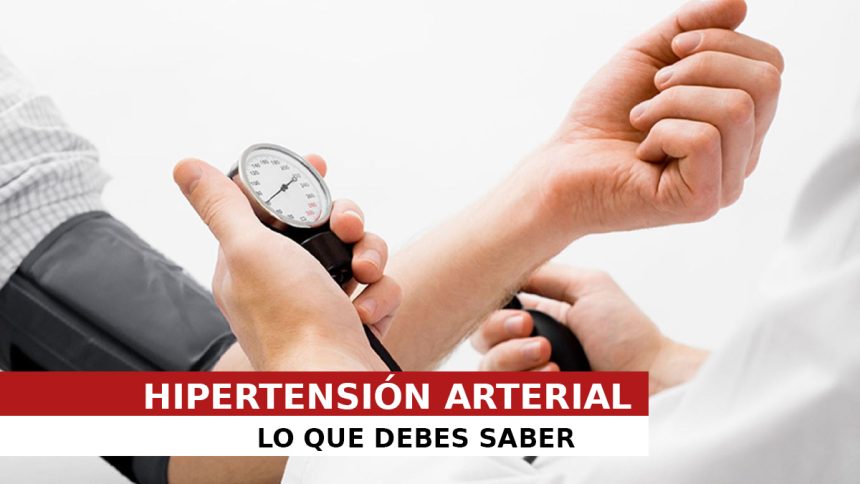 HIPERTENSION ARTERIAL. LO QUE DEBESMOS SABER HIPERTENSION ARTERIAL. LO QUE DEBESMOS SABER